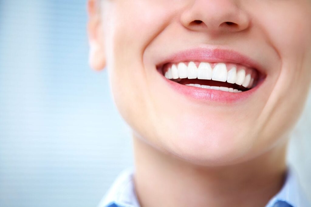 veneers in Palmdale